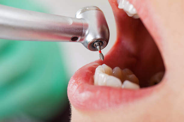 Best Emergency Denture Repair in Locust Grove, OK